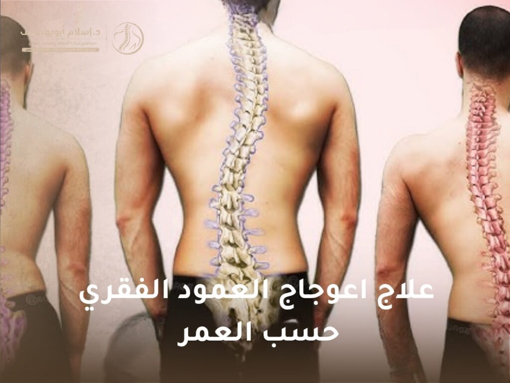 علاج اعوجاج العمود الفقري حسب العمر
