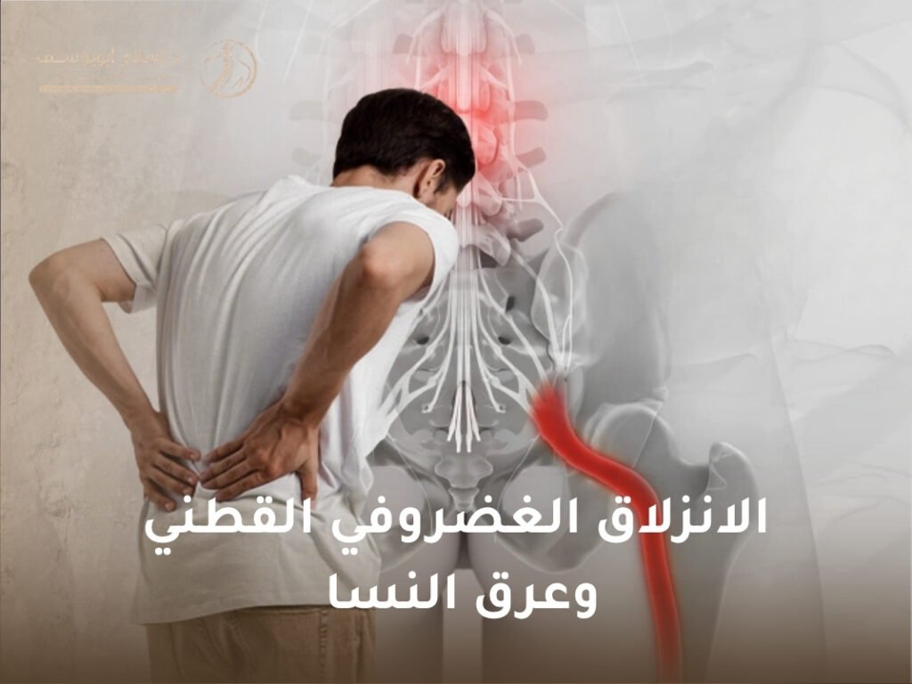 الانزلاق الغضروفي القطني وعرق النسا