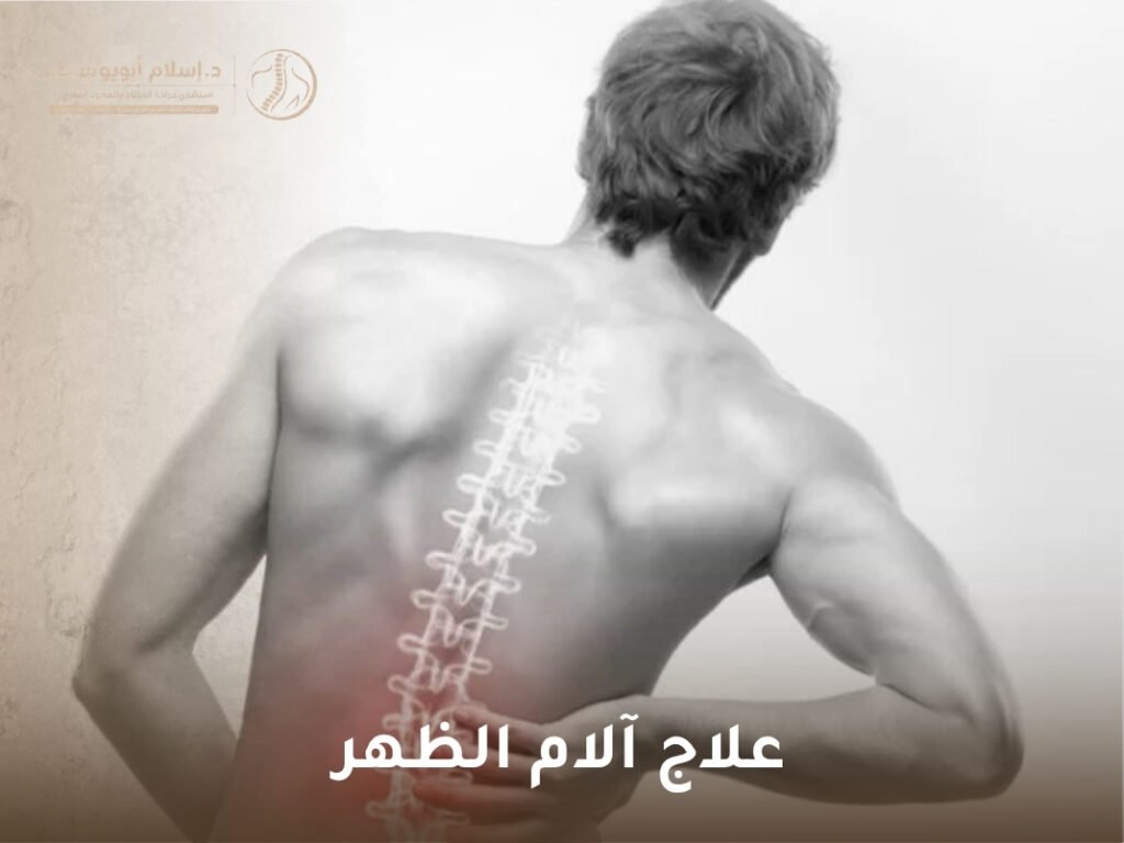 علاج آلام الظهر