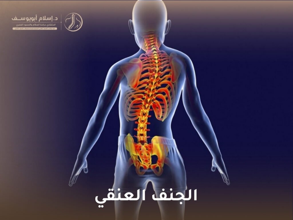 الجنف العنقي