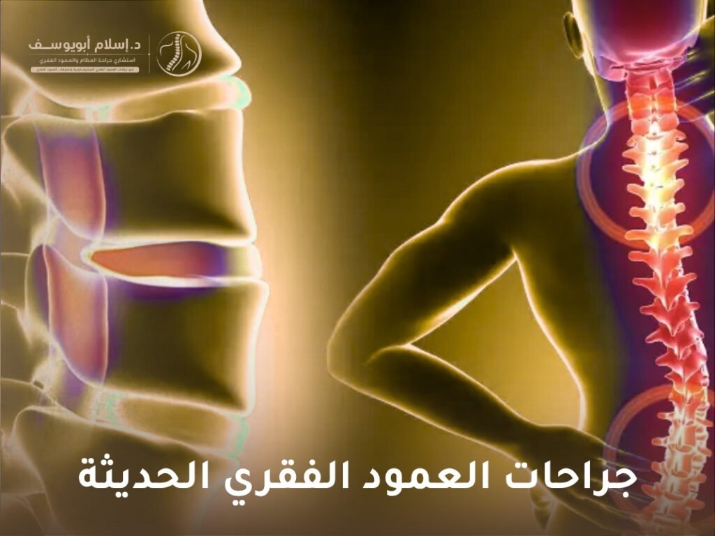 جراحات العمود الفقري الحديثة