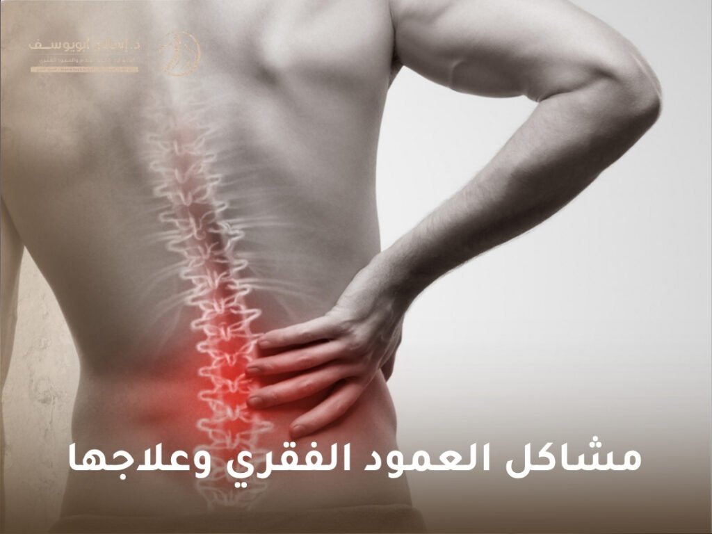 مشاكل العمود الفقري وعلاجها