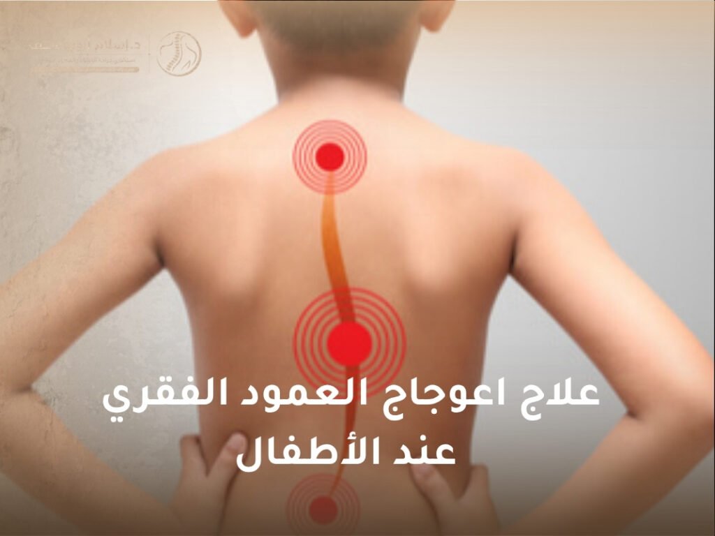 علاج اعوجاج العمود الفقري عند الأطفال