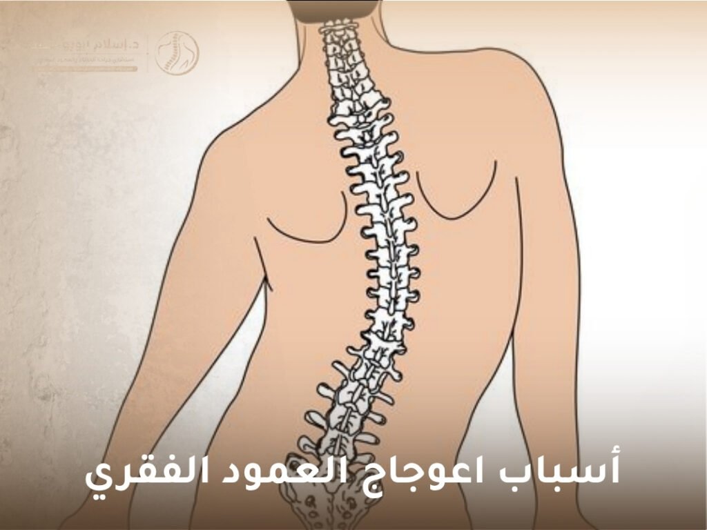 علاج اعوجاج العمود الفقري