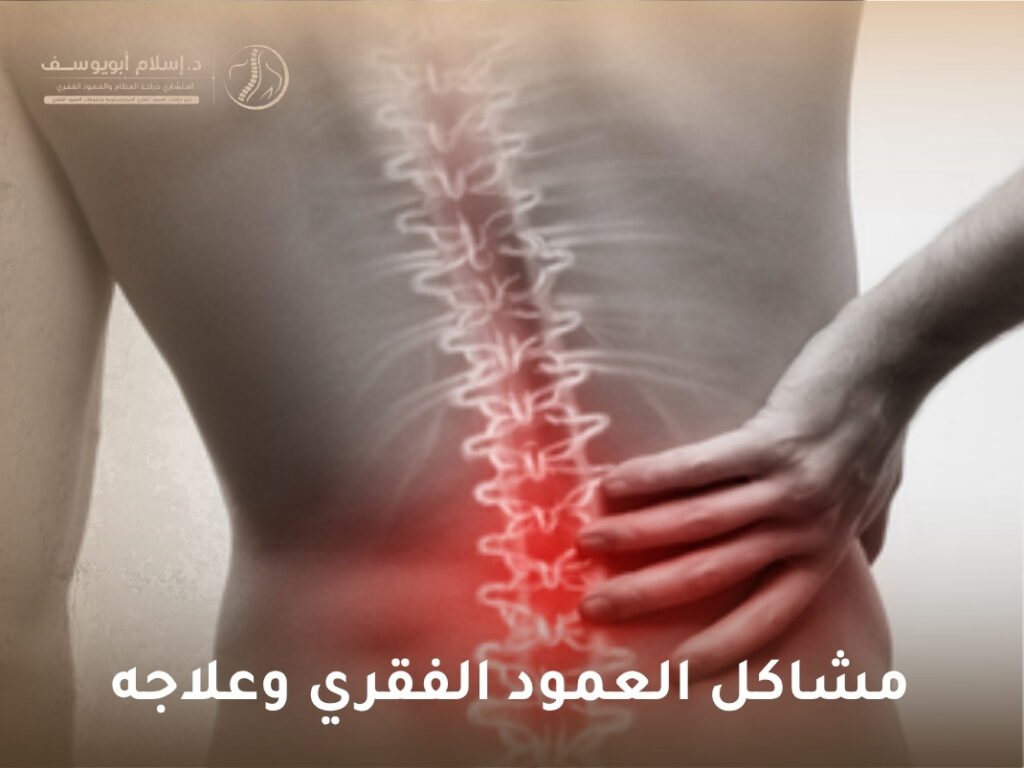 مشاكل العمود الفقري وعلاجه