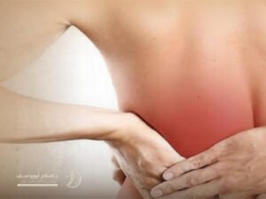 علاج آلام الظهر