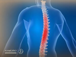 حالات شفيت من الجنف