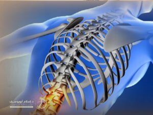 جراحات العمود الفقري الحديثة