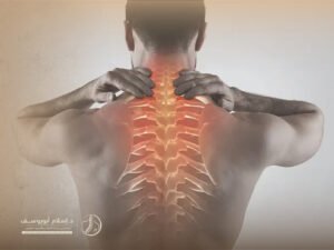 تجربتي مع غضروف الرقبة