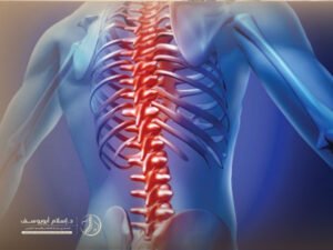 أفضل دكتور عمود فقري في مصر
