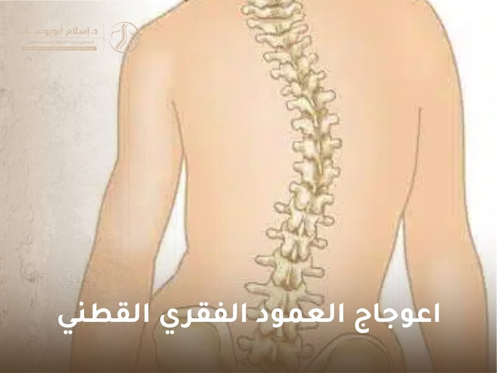 اعوجاج العمود الفقري القطني