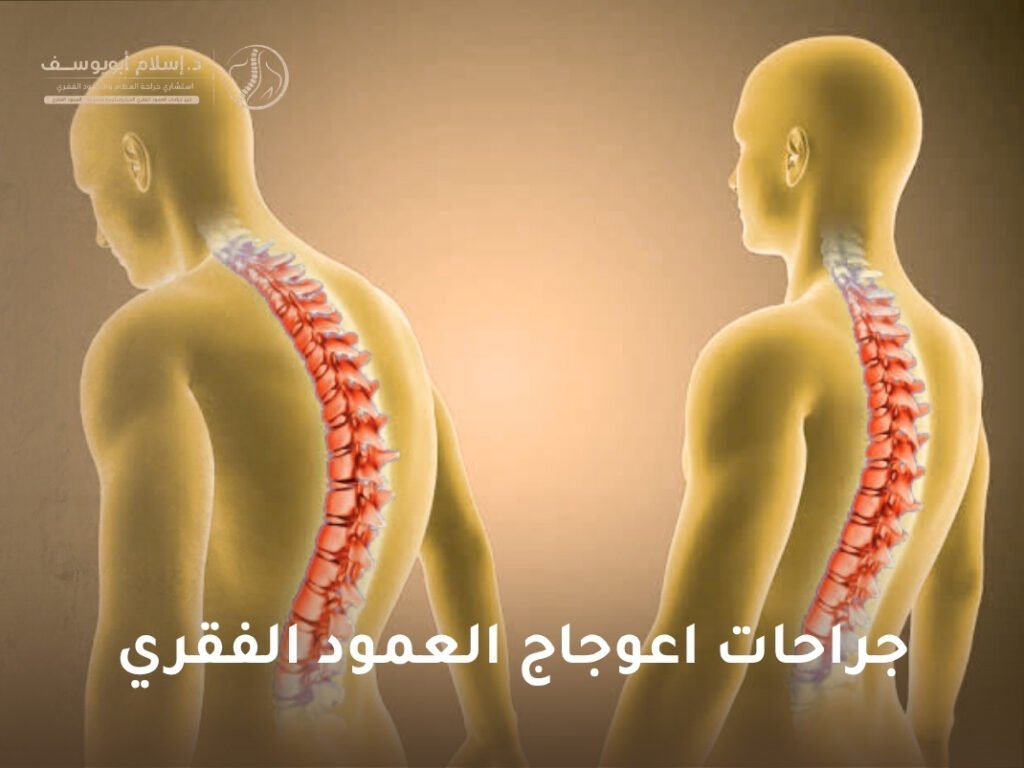 جراحات اعوجاج العمود الفقري