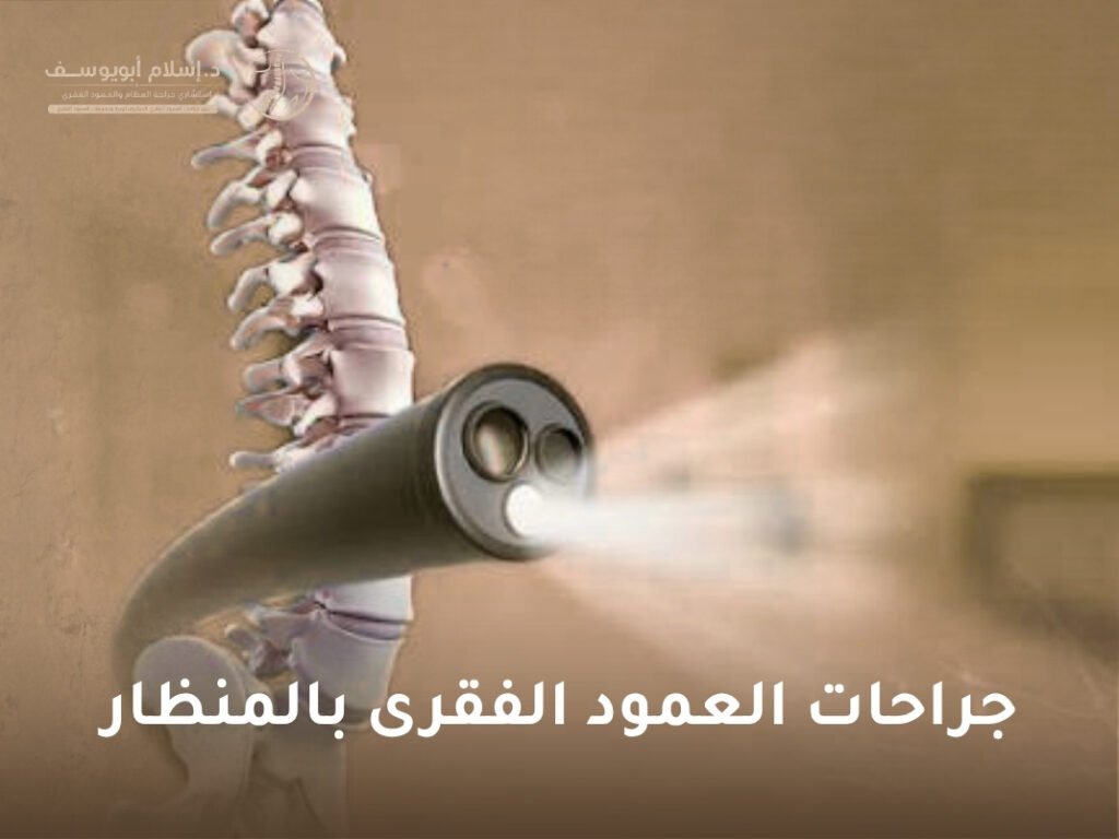 جراحات العمود الفقرى بالمنظار