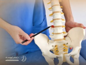 علاج الانزلاق الغضروفي القطني
