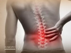 اعوجاج العمود الفقري القطني