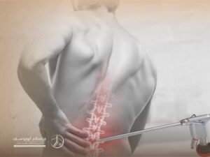 جراحات العمود الفقرى بالمنظار