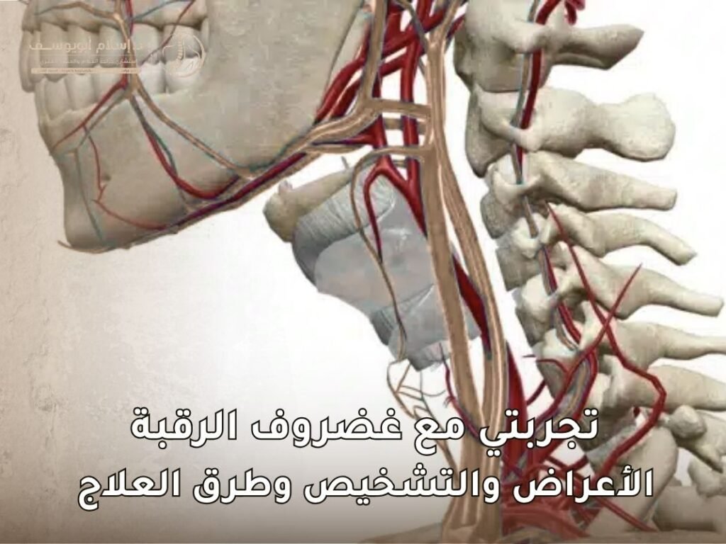 تجربتي مع غضروف الرقبة