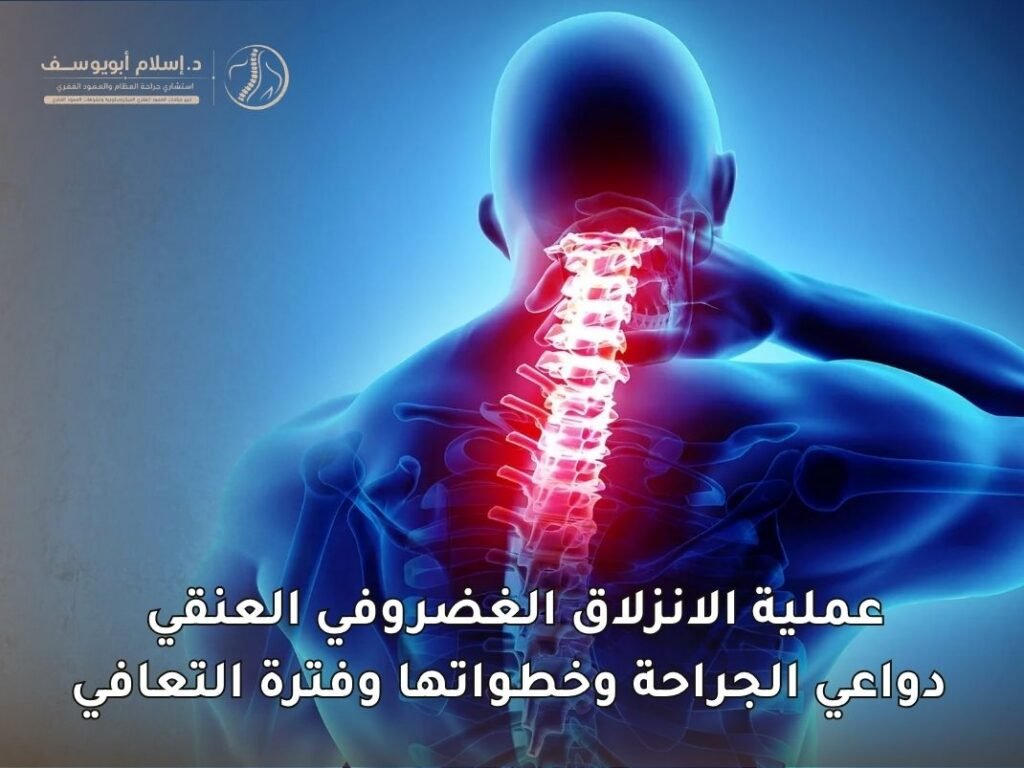 عملية الانزلاق الغضروفي العنقي