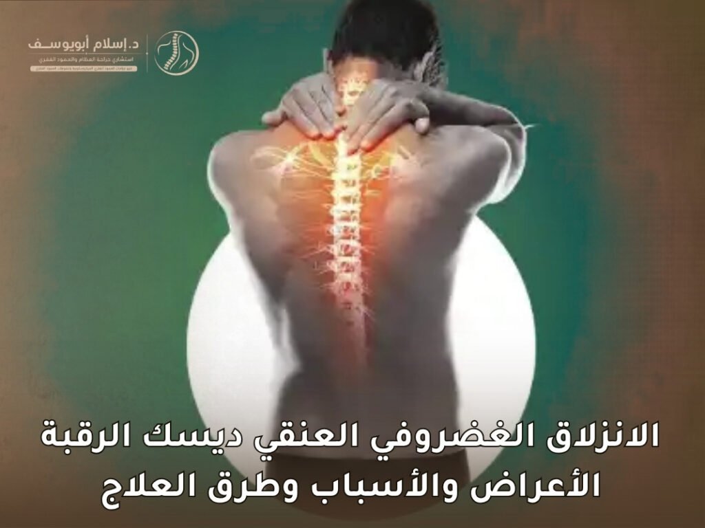 الانزلاق الغضروفي العنقي ديسك الرقبة