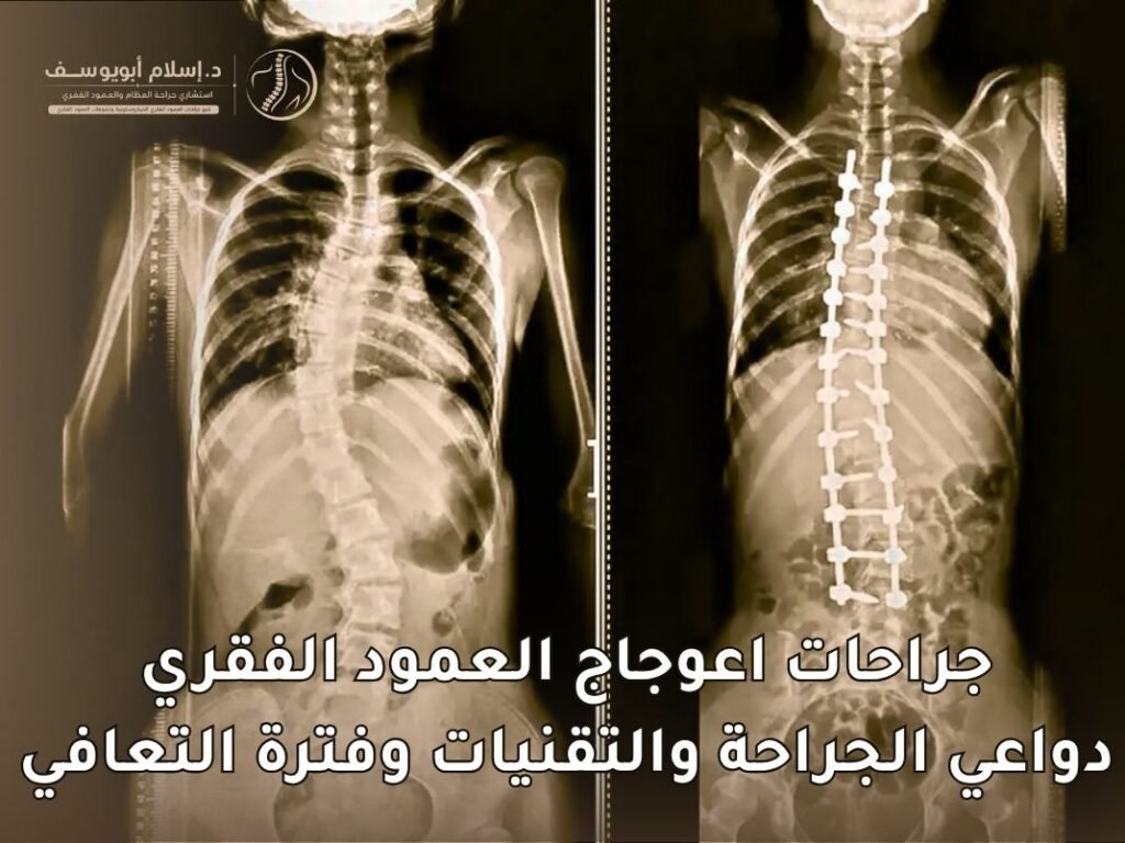 جراحات اعوجاج العمود الفقري