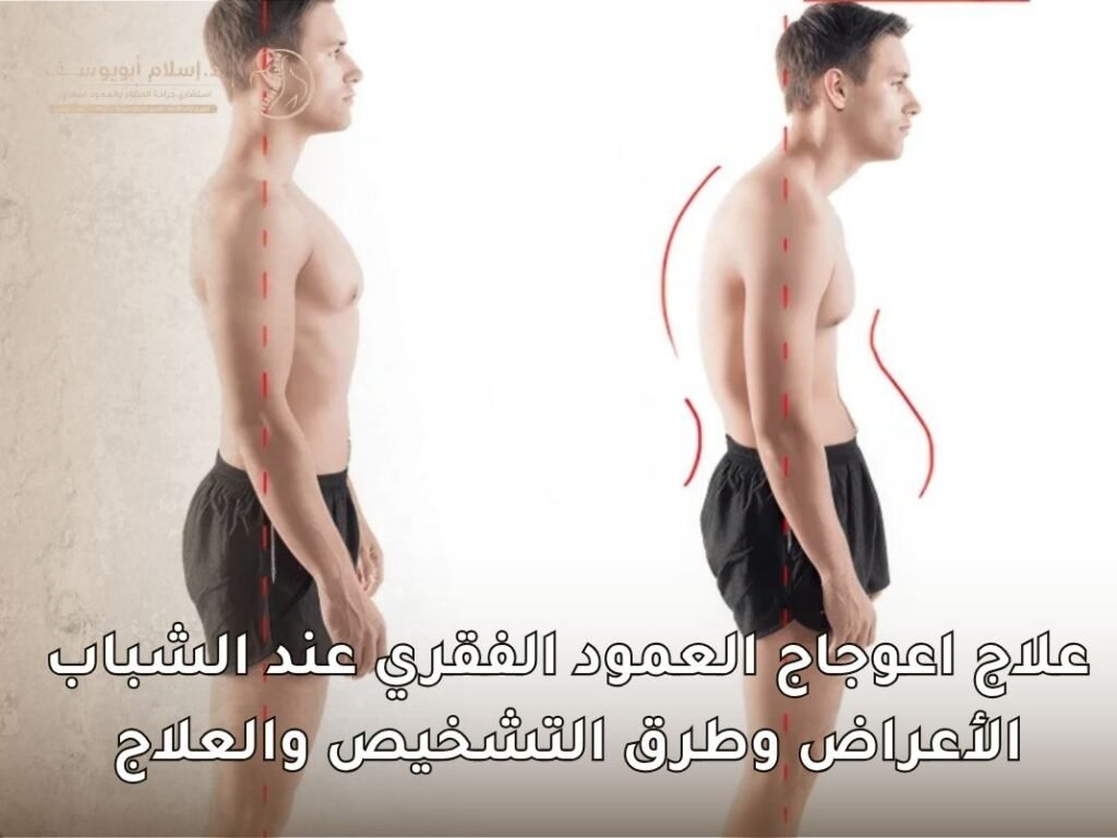 علاج اعوجاج العمود الفقري عند الشباب
