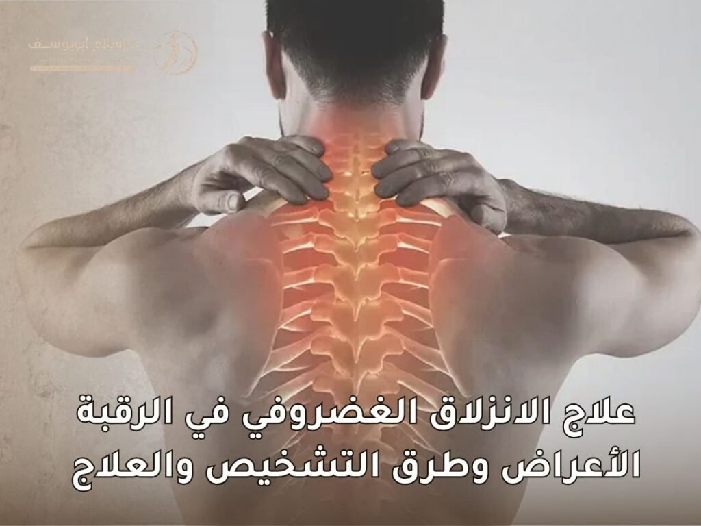 علاج الانزلاق الغضروفي في الرقبة