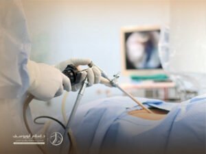 اسعار عمليات اعوجاج العمود الفقري