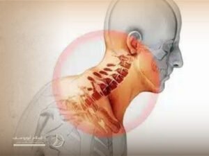 تجربتي مع غضروف الرقبة