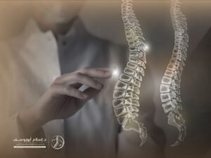 علاج اعوجاج العمود الفقري عند الكبار