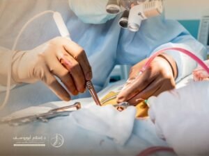 عملية اعوجاج العمود الفقري بالمنظار